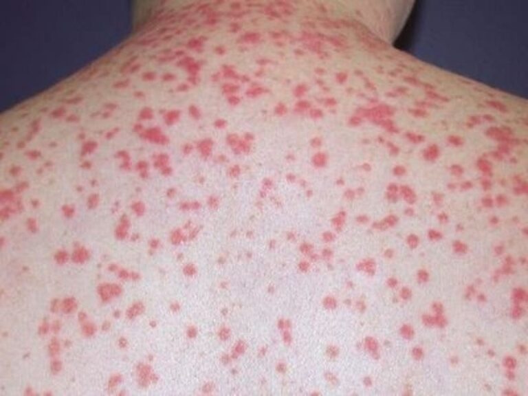 カイエンペッパー