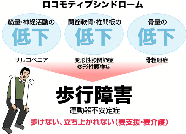 【ロコモ】て何?どうすればいいの?横須賀にお住いのあなたへ - 湘南山手マッサージ治療院