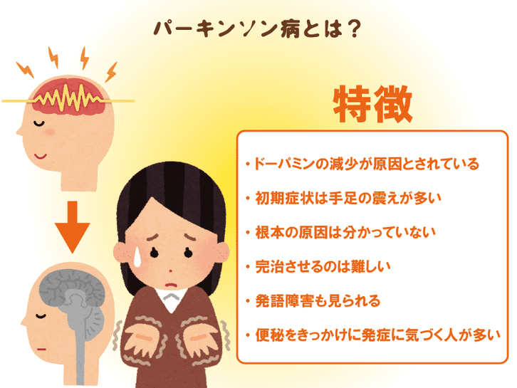 パーキンソン病の特徴を表したイラストです。
