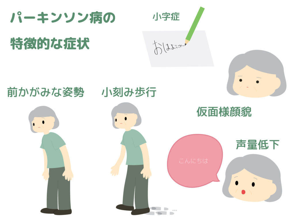 パーキンソン病の特徴を表したイラストです。