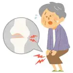 変形性膝関節症で痛みを訴えている高齢女性のイラストです。